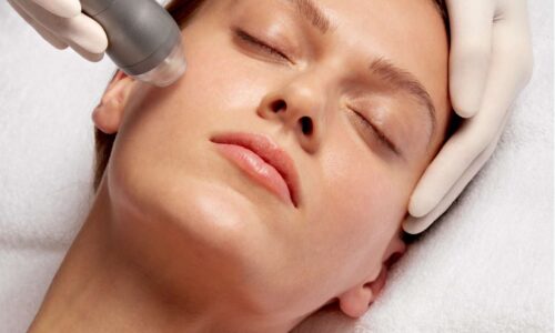 Microdermabrasie Microdermabrasie